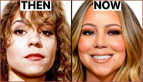 A Close Look At Mariah Carey's Plastic Surgery Transformation?
